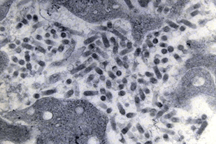 Fish disease close-up