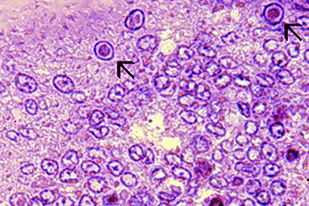 Fish disease close-up