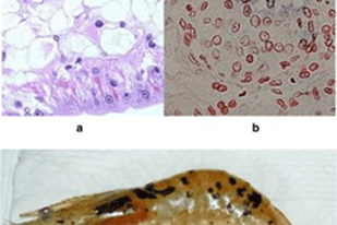 Fish disease close-up