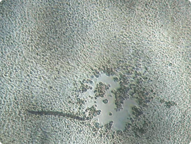 Light Micrograph of Plaque Caused by IHN Virus
