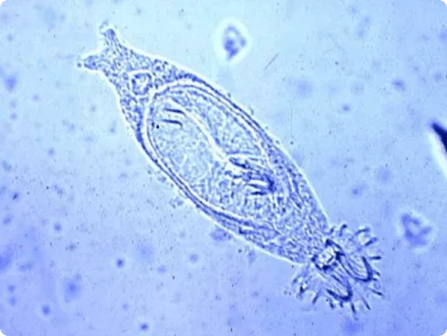 Living, Adult Gyrodactylus in Fresh Mount Preparation