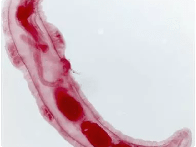 Male Neoechinorhynchus sp