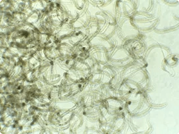 Mass of Adult Philonema Nematode Worms