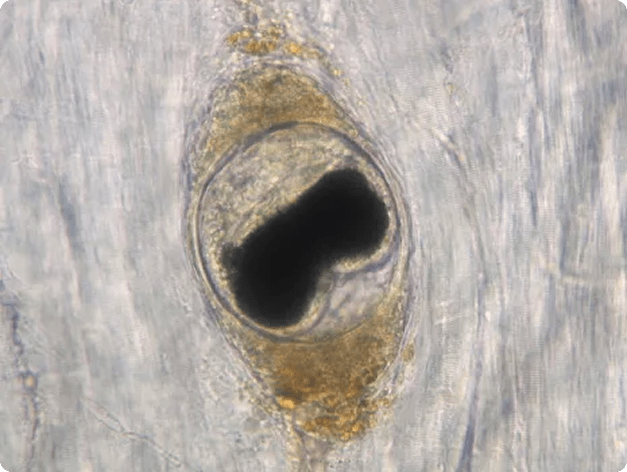 Metacercaria of Nanophyetus in Muscle
