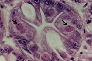 Fish disease close-up