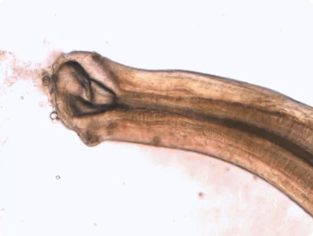 Mouthparts of a Truttaedacnitis Nematode