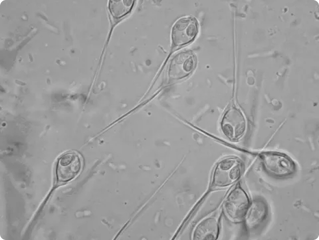 Muscle Tissue Infected