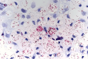 Fish disease close-up
