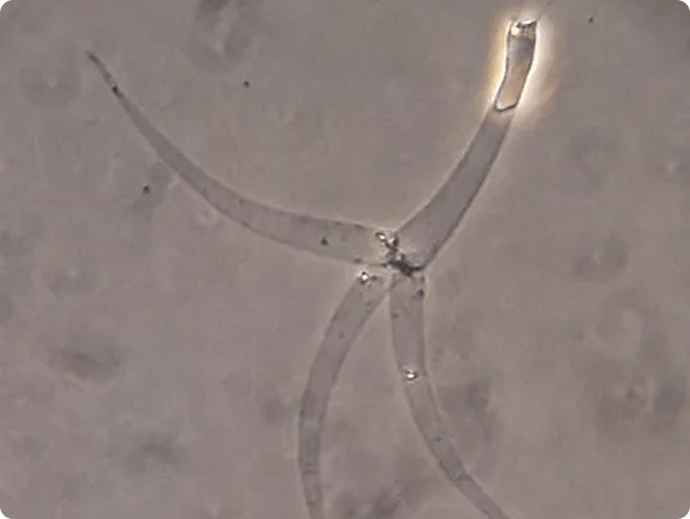 Myxobolus cerebralis Actinospore with Fired Polar Filaments