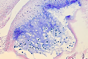 Fish disease close-up