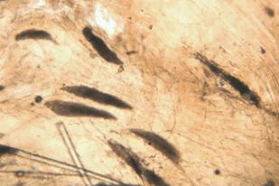 Fish disease close-up