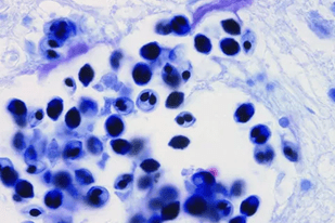 Fish disease close-up