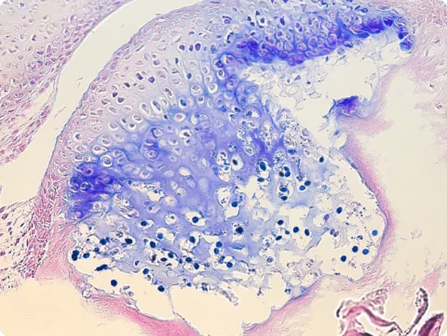 Myxosporean Infection in Head Cartilage of Rainbow Trou