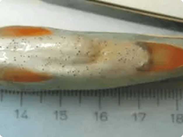 Nanophyetus Metacercaria (Black Spots) on Ventral Surface of Fish