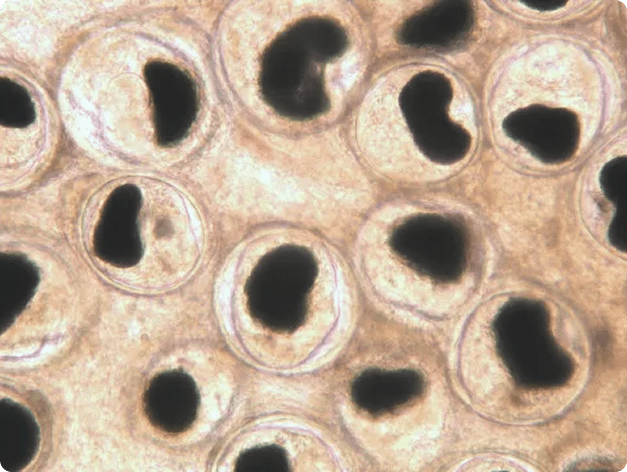 Nanophyetus Metacercaria in Fresh Tissue Squash of Intestine