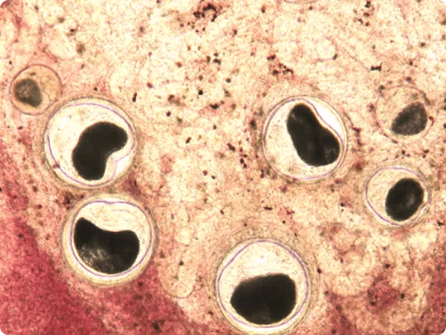 Nanophyetus Metacercaria in Fresh Tissue Squash
