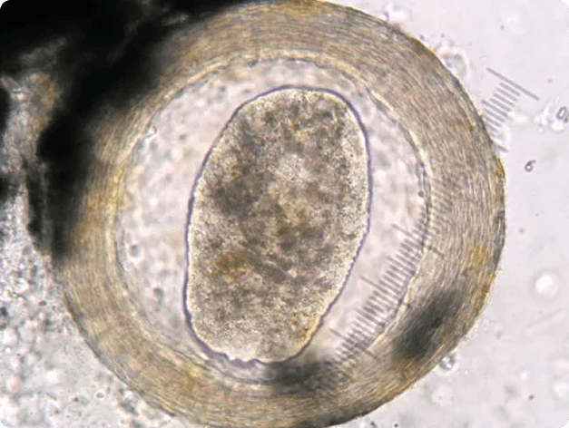 Neascus Metacercaria Exscised from the Skin of an Infected Fish