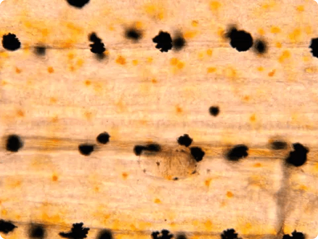 Neascus Metacercaria Not Yet Attached by the Dark, Melanin-Rich Pigment Cells