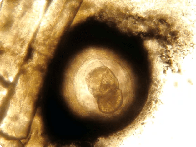 Neascus Metacercaria Surrounded by Dark Pigment Cells in the Skin of a Fish