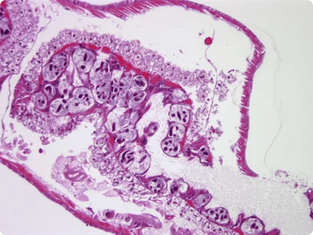 Pansporocysts of Myxobolus cerebralis Developing in Gut Wall of Tubifex Worm