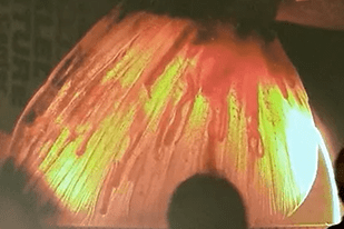 Fish disease close-up