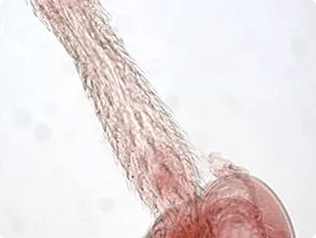 Proboscis of Echinorhynchus gadi