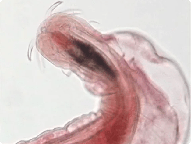 Proboscis of Female Neoechinorhynchus sp.