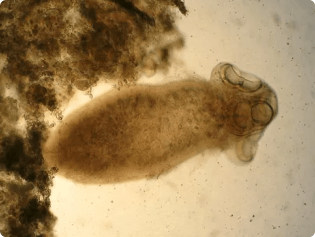 Proteocephalus plerocercoid