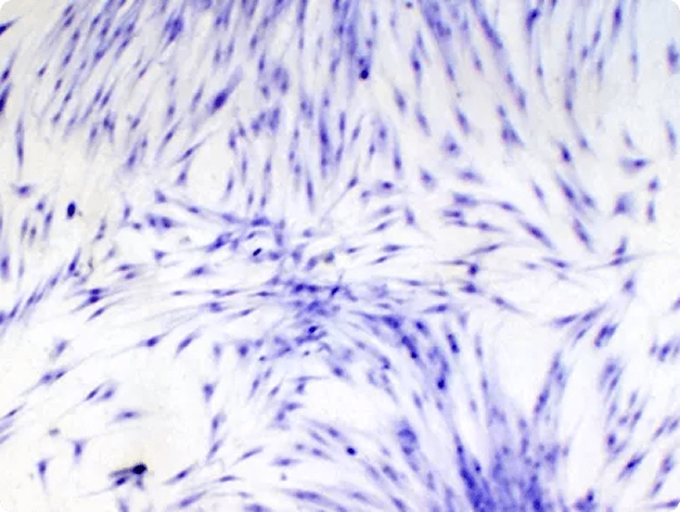 RTG-2 Cells Inoculated with IPNV
