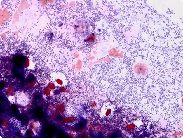 Renibacterium visible in histological section