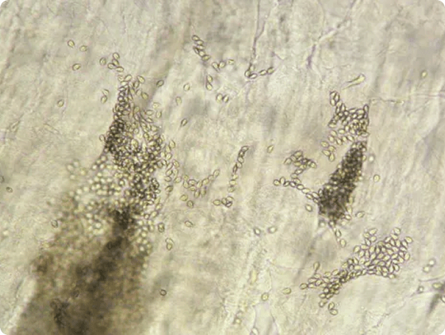 Ruptured Myxobolus insidiosus Cysts in Muscle