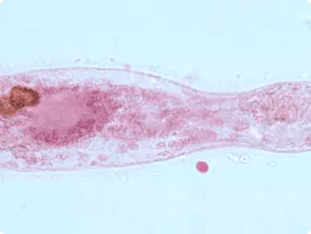 Sanguinicola Blood Fluke Miracidium