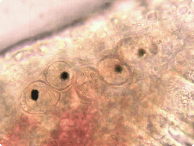 Sanguinicola Blood Flukes in Blood Vessels of Gills