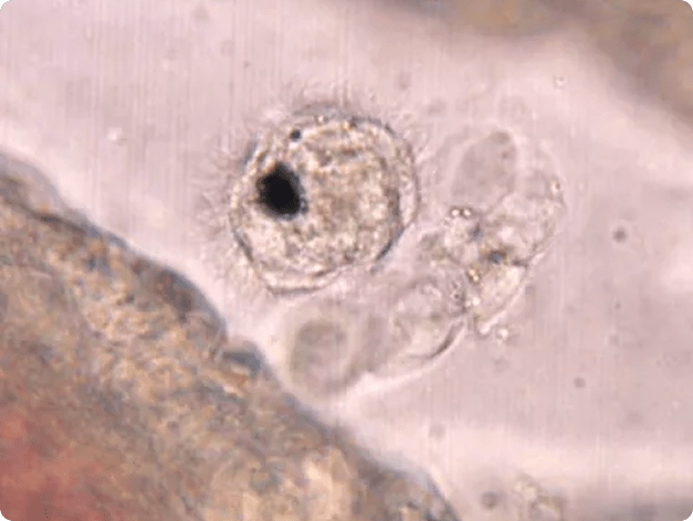 Sanguinicola in Gills
