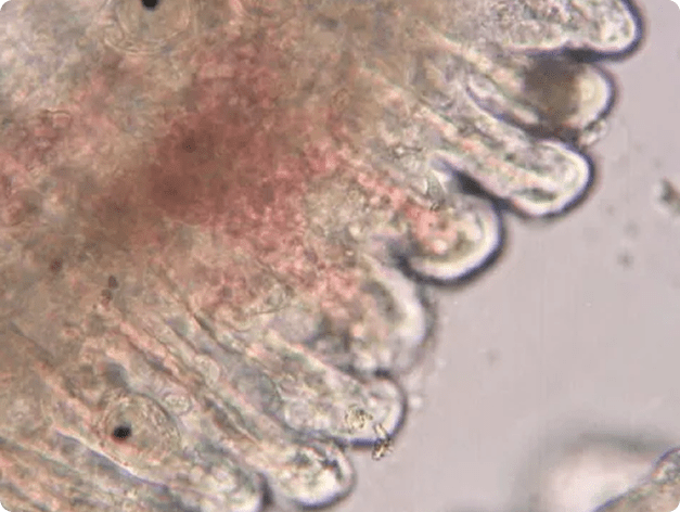 Sanguinicola Miracidium Near Gill Filamen