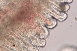 Fish disease close-up