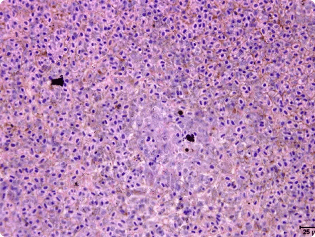 Spleen damaged by Yersinia ruckeri infection