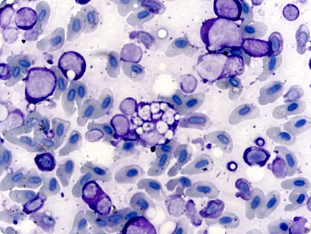 Stained Blood Smear Showing Characteristic Basophilic Inclusion Bodies