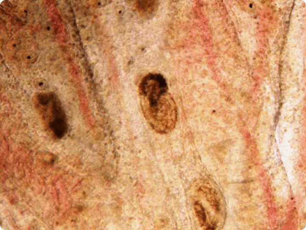 Trematode Metacercaria in Gills (Likely Heterophyidae)