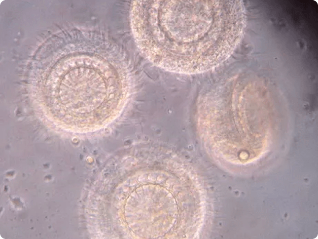 Trichodina