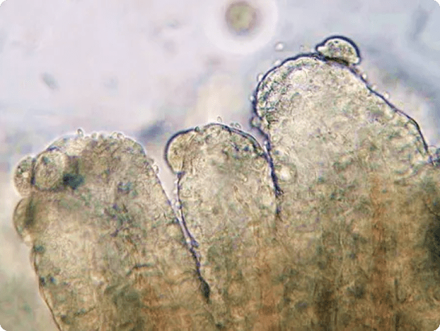 Trichodinella