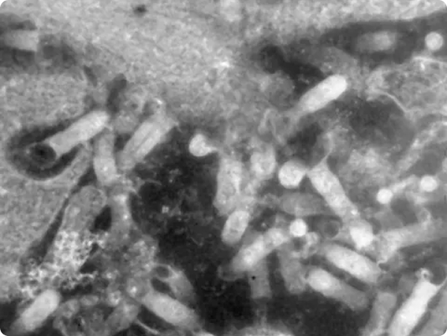 VHSV Particles Under Electron Microscopy