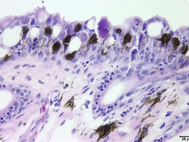 Viral Infection in Kidney of White Sturgeon