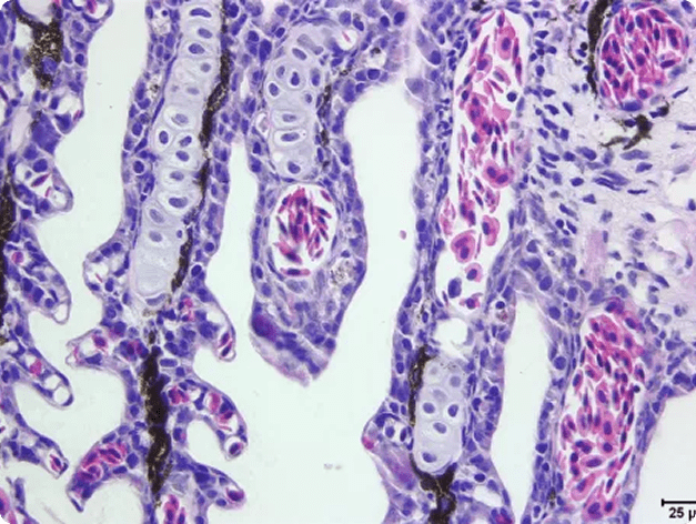 White Sturgeon Gills Infected with Virus