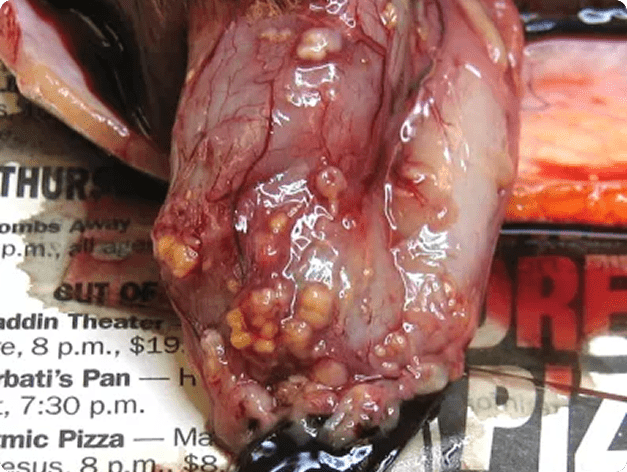 Diphyllobothrium plerocercoids on gut of rainbow trout